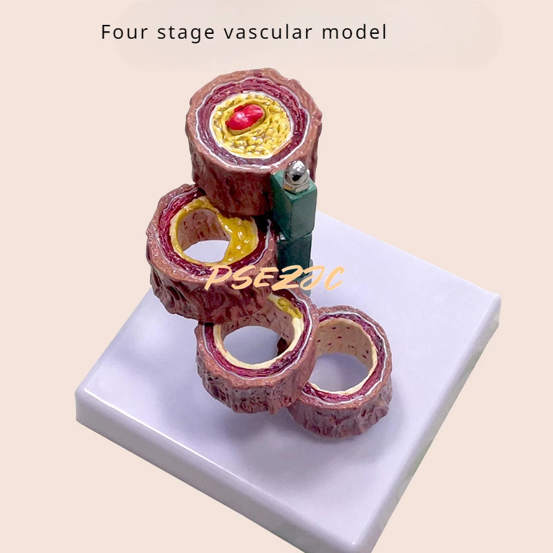 PVC Coronary Cardiovascular Model Sclerosis Elderly Heart  Vascular  Medical Teaching Supplies