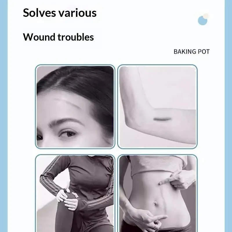 Zipper Band-aid Painless Wound Closure Device Suture-Free Hypoallergenic Adhesive Patch for Sensitive Skin Use