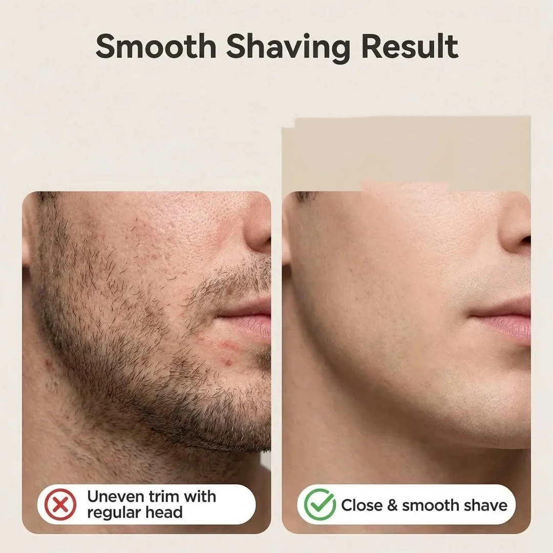 Thumbnail 4 - #38 Latest Razor Blades Offers
