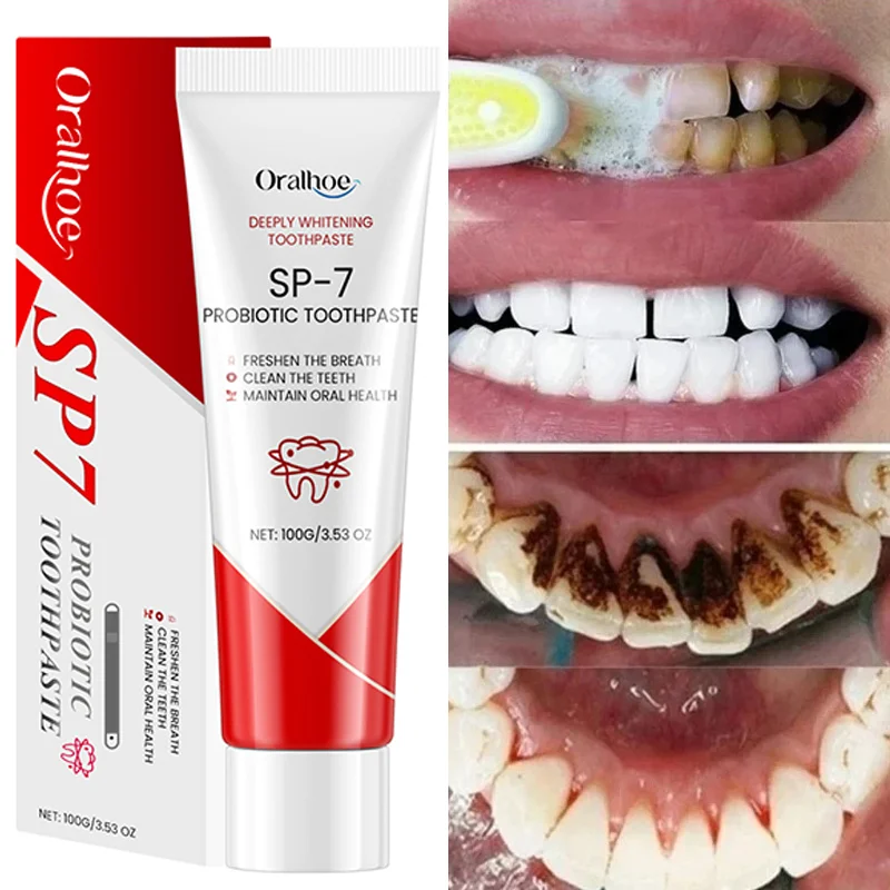 Pasta de dientes probiótica SP-7 para blanquear los dientes, elimina manchas, gestión del cuidado bucal, aliento fresco con sacarin DE SODIO, lactobacilos