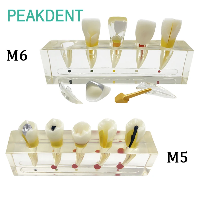 

Dental Endodontic Clinical Model Oral Teaching Dental Model Dental Training Treatment Demonstration Patient Communication