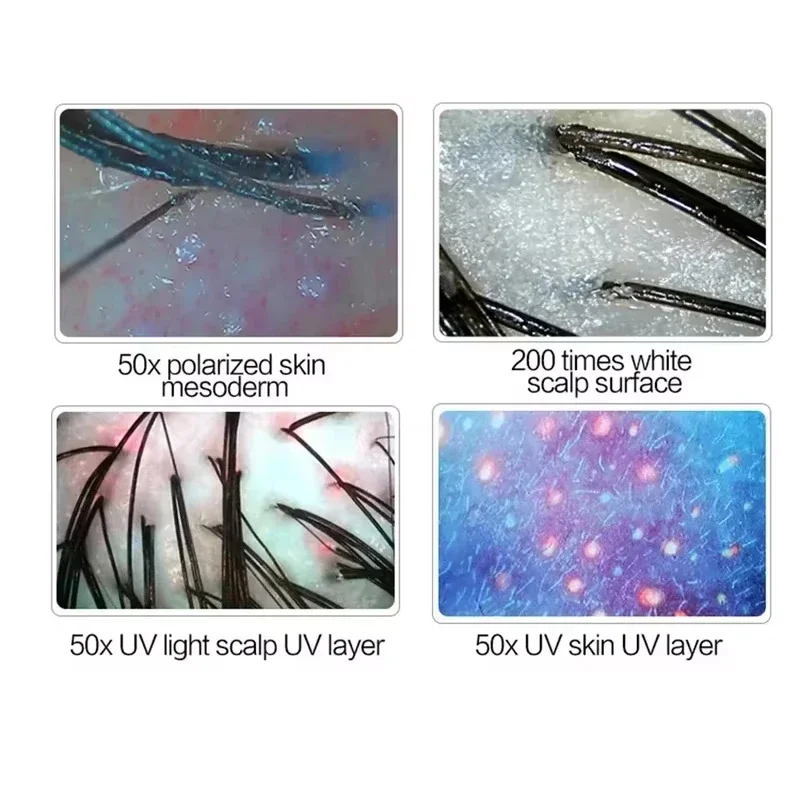 

Многофункциональный салонный анализатор фолликулов кожи, УФ-анализатор волос тройного спектра для косметической терапии и ухода за волосами