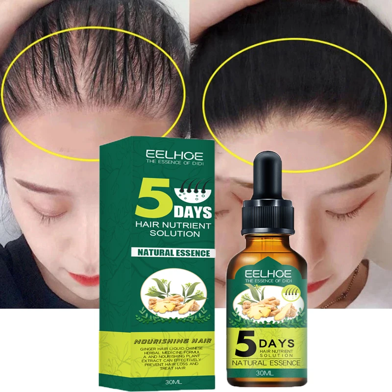 Natural Ginger Hair Growth Products, Anti Hair Loss, Prevenir a calvície, tratamento, crescimento rápido, nutrido, seco, danificado Hair Care, 5 dias