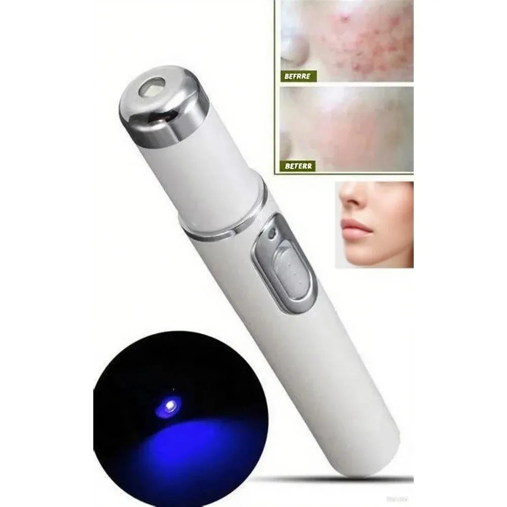 

Blue LED Acne Pen Device, Professional Pore Minimizer, Skin Refiner for Smoother Complexion