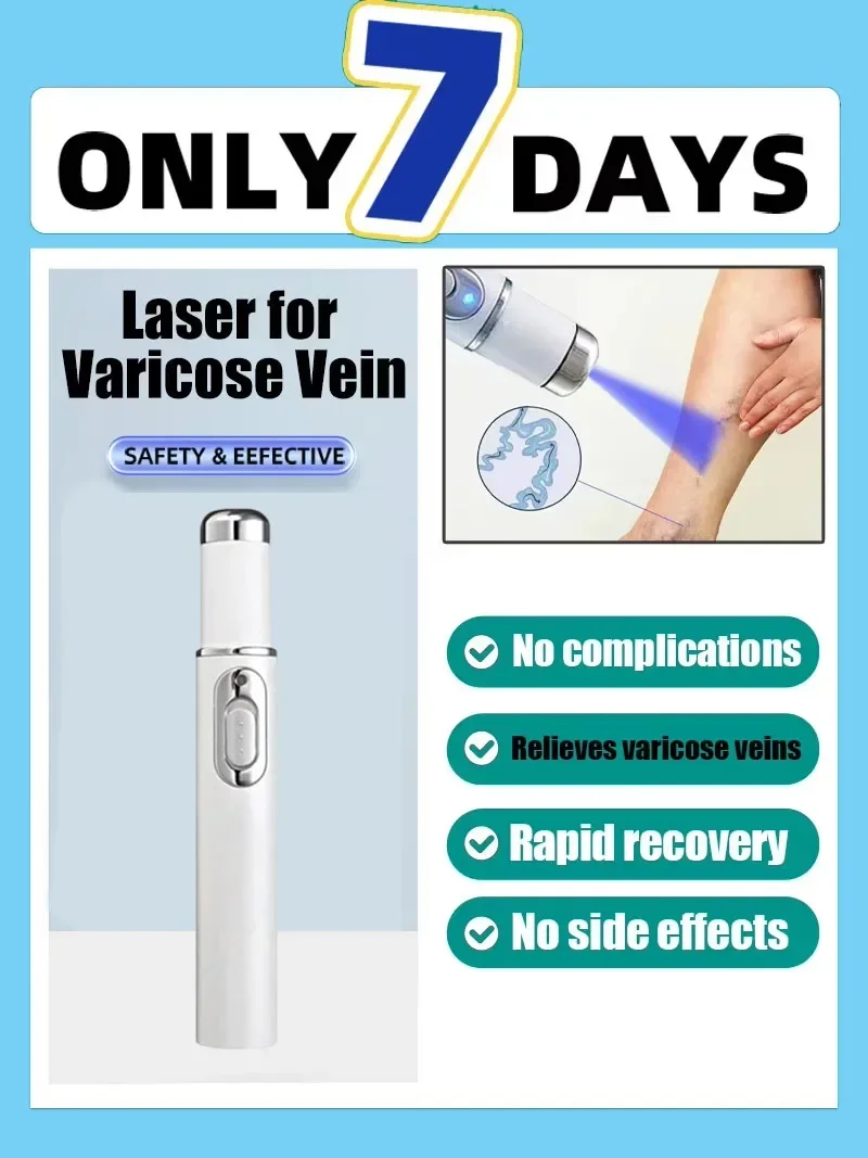 قلم ليزر أزرق مطور حديثًا، يحل الدوالي، مما يسمح لك أن تتمتع بأرجل صحية جديدة 2020 #3