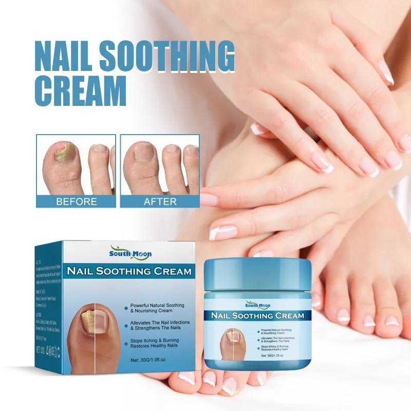 Nail Soothing Cream Repair Onychomycosis Treat Damaged Nails Thickening Nail Type Nourishing Essence Health Beauty Care Cream