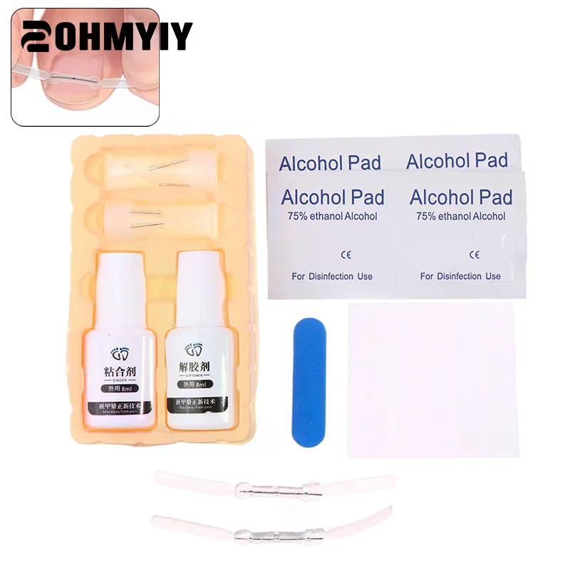 4 szt./zestaw Narzędzie do korekcji wrastających paznokci Elastyczna naklejka do leczenia wrastających paznokci Klips prostujący Paznokcie Narzędzie do pedicure