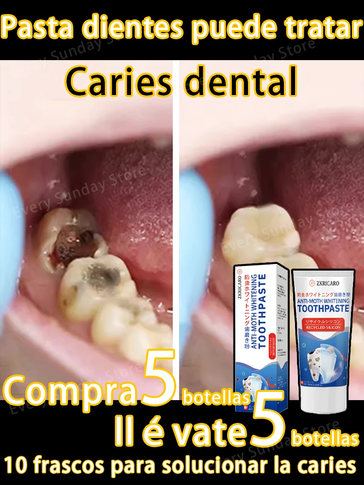 Decaimiento dental