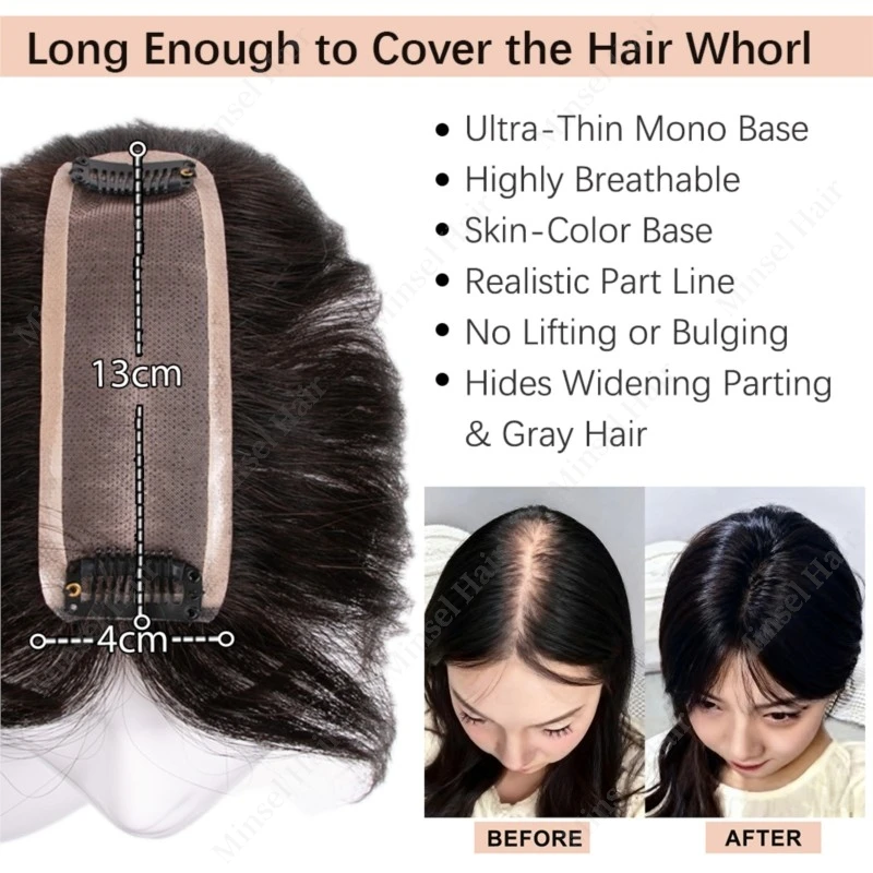 Thumbnail 2 - #19 Hair Toppers For Women Comparison Guide