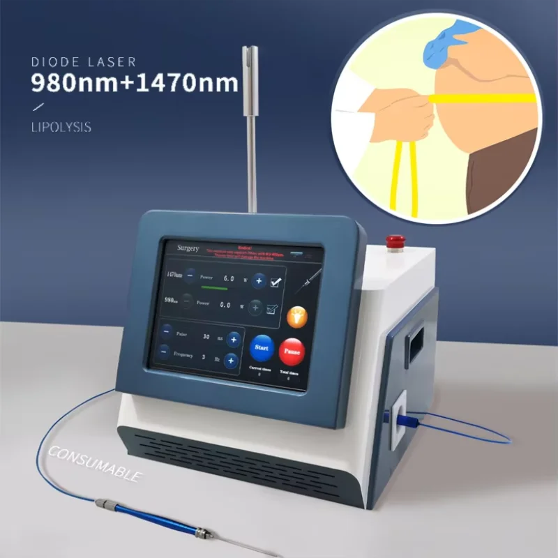 

1470 980-nanometer diode laser liposuction machine, used for weight loss and fat breakdown - skin tightening