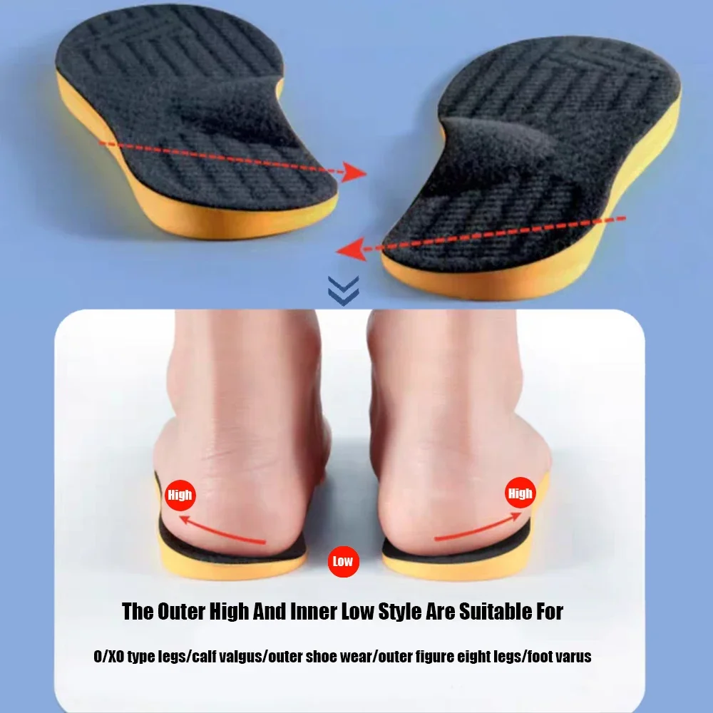 iFitna 2 pairs Orthopedic Insole Flat Feet Arch Support Men Women O/X Leg Corrected Orthotic Insert Shock Absorb Stand All Day