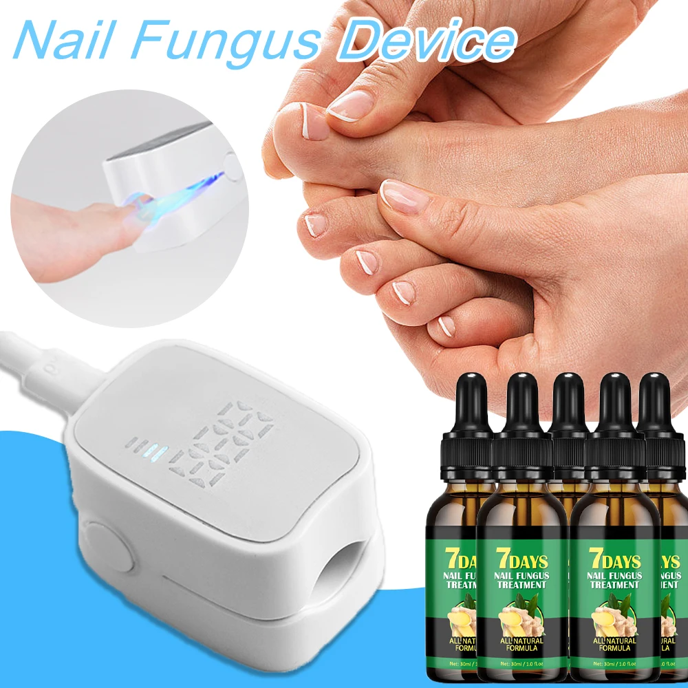 Fungal Nail Treatment Oil Foot Repair Essence Toe Nail Fungus Removal Gel Anti Infection Cream Fungal Nail Removal 30ML