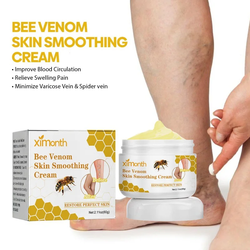 Bee Venom Vein Repair Cream To Relieve Leg Soreness and Swelling and Smooth Bulging Veins