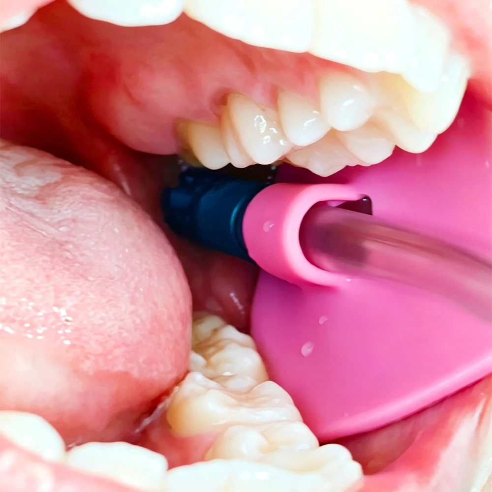 1 Stück/10 Stück/50 Stück Autoklavierbarer Dentaler Absaugschlauchhalter, Mundpflege-Werkzeug, Speichelablass, HVE-Schlauch-Lokalisator – Detail 5