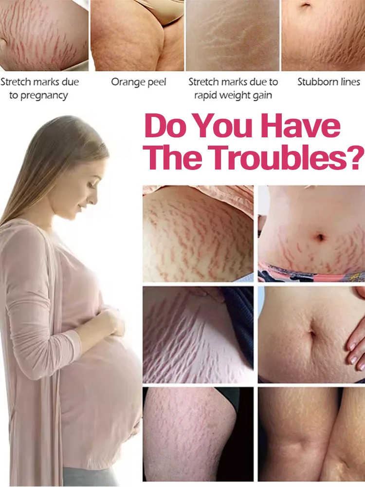 Essential oil line: restore the skin of the stomach, thighs, chest