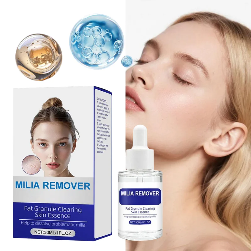 30ml Milia Remover Skin Essence Gentle Formula Fat Granule Clearing Essence for Smooth Skin Deep Hydrating Repairing Serum