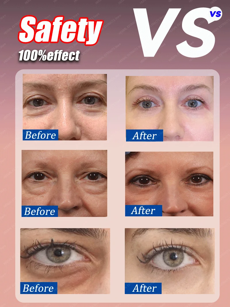Snelle Oogzak Remover Retinol Anti-rimpel Verstevigende Huid Lichter Fijne Lijntjes Anti-donkere kringen Wallen Heldere Oogverzorging