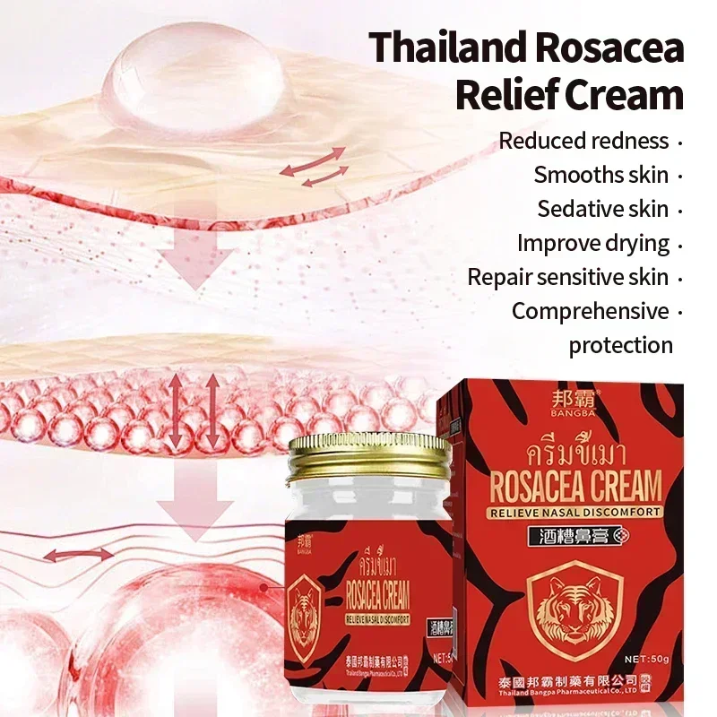 Thailand Rosacea Treatment Cream Anti Nose Mites Blackhead Acne Remover Red Nose Repair Face Shrink Pores Skin Care