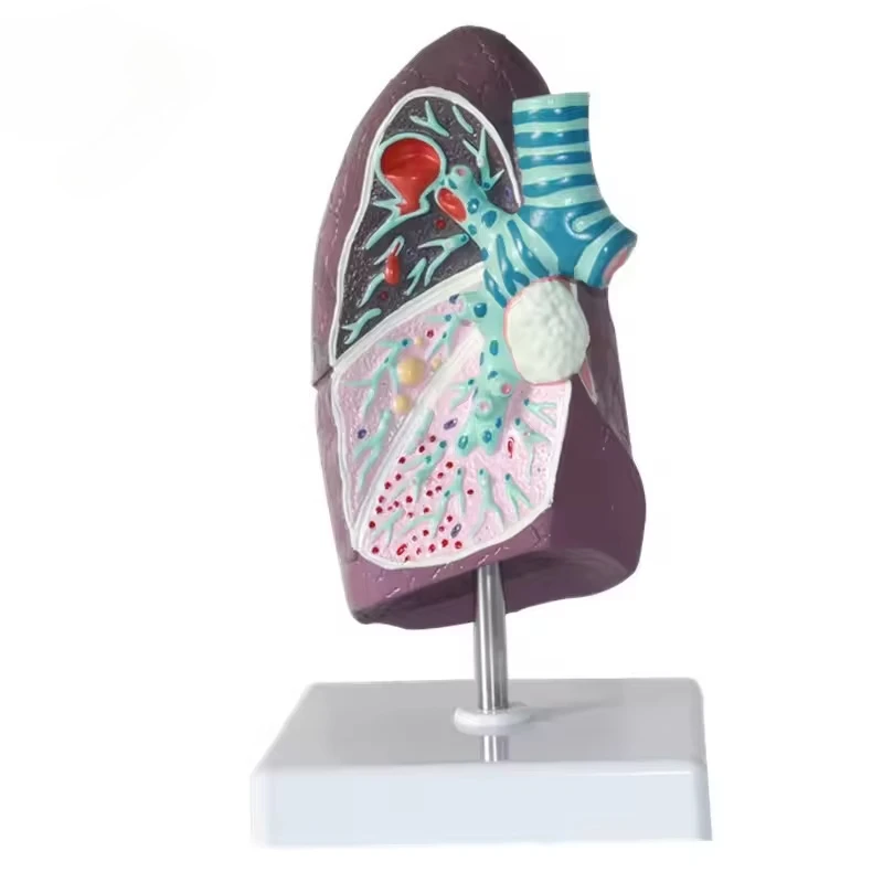 

Teaching Resources Teaching Aids High Quality Anatomy Human Anatomy Medical Lung Model