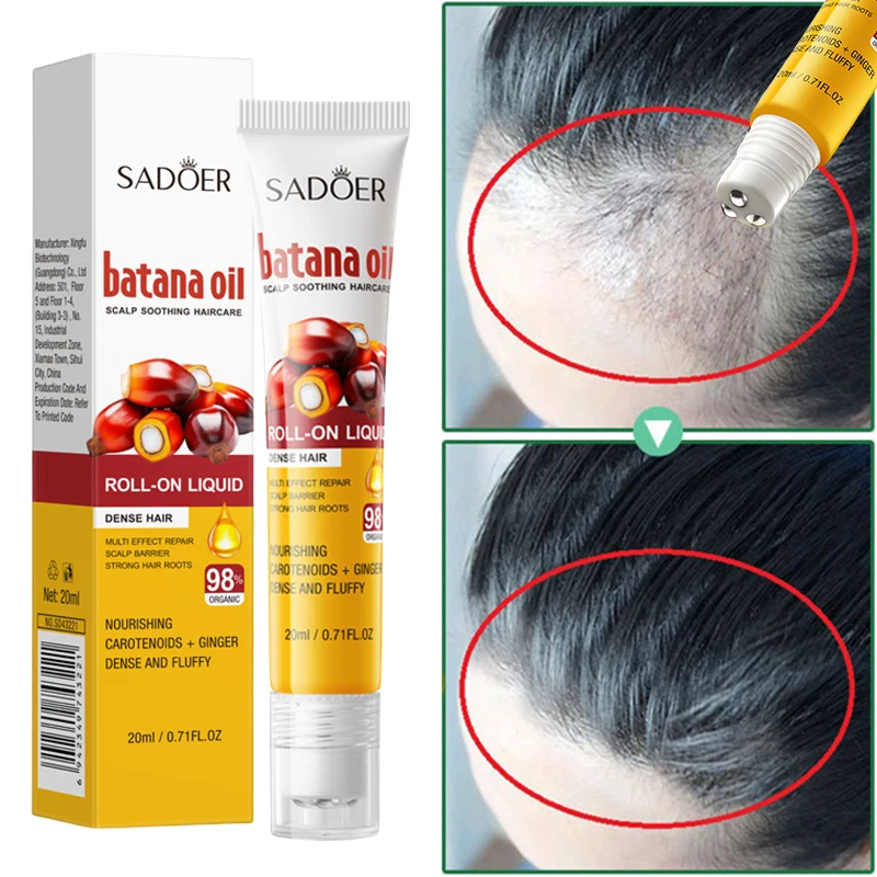 Batana Oil Hair Growth Serum Hair Care Hair Loss Treatment Fast 7Days Hair Growth Solution For Men Women Thickening Moisturizing