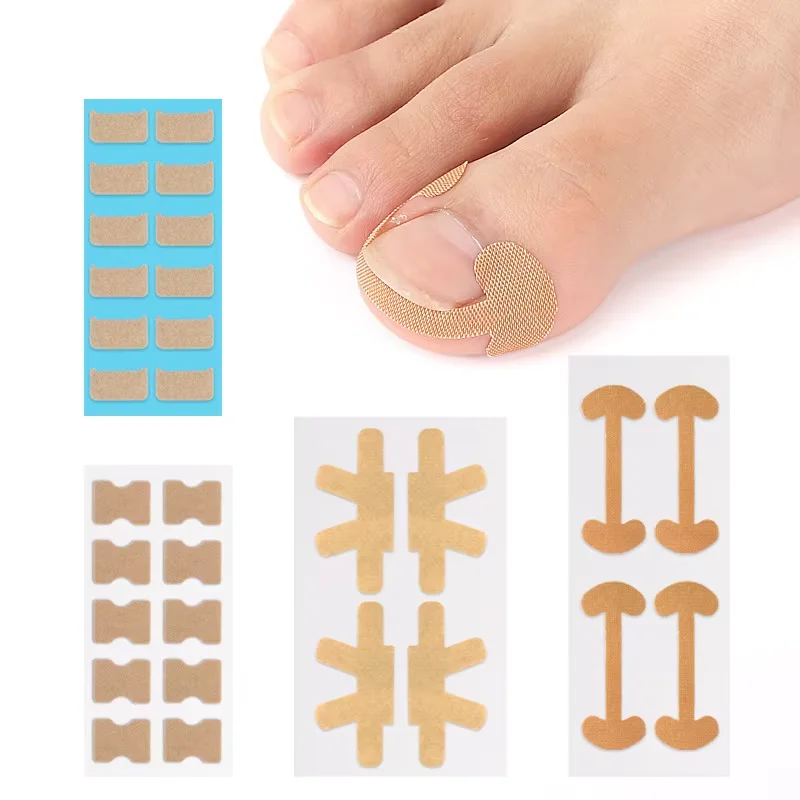 

4/10/12Patch Nail Correction Stickers Ingrown Toenail Corrector Patches Paronychia Treatment Recover Corrector Pedicure Tools