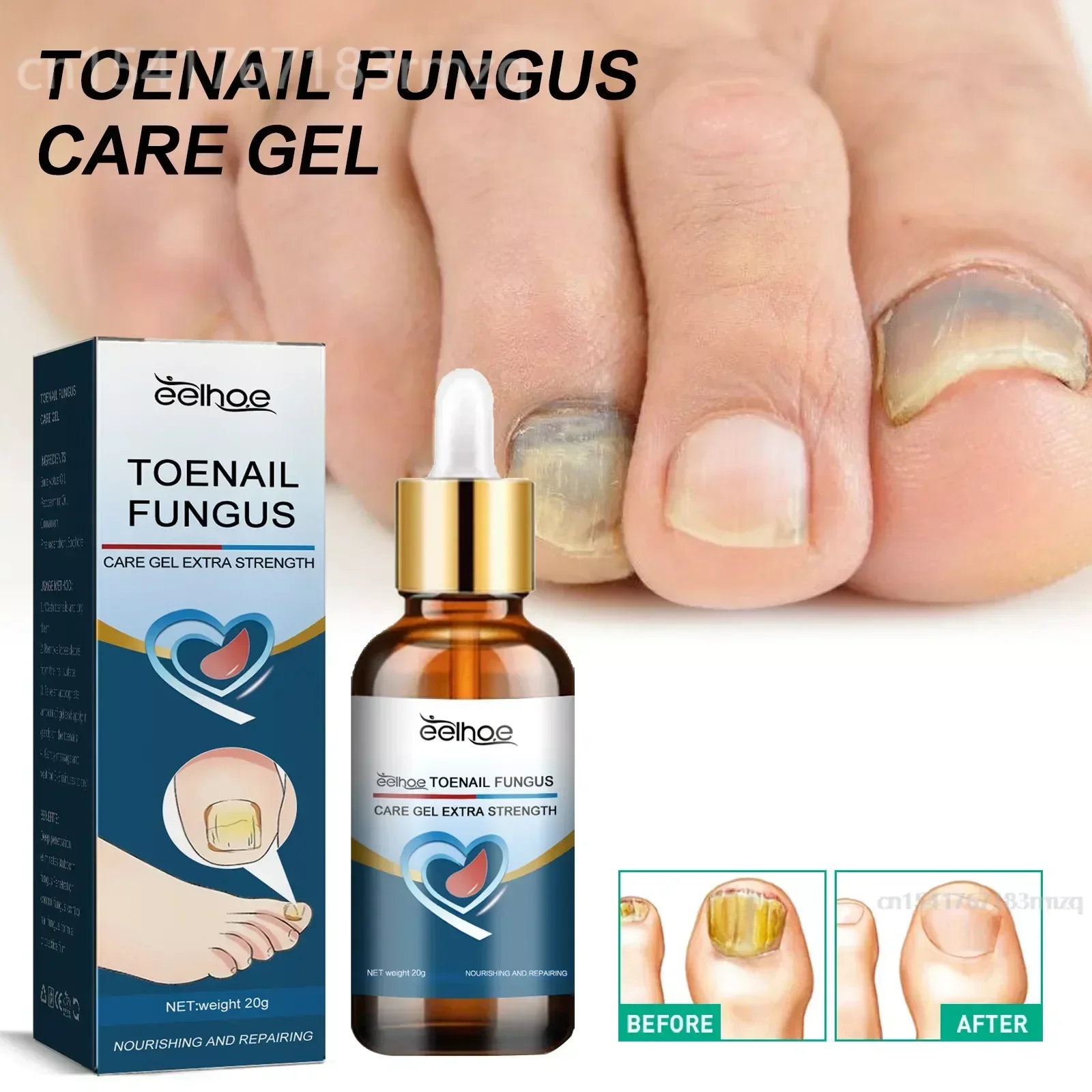 Repair for Damaged Nails for Toenail or Fingernail Safe Nail Solution for Discolored Damaged Nails