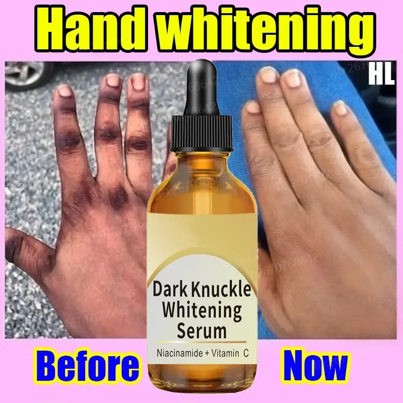 Whitening Hand Serum Quick Knuckle Lightening Essence Moisturize Knees Whiten Essential Oil Niacinamide Knuckles Brighten Serum