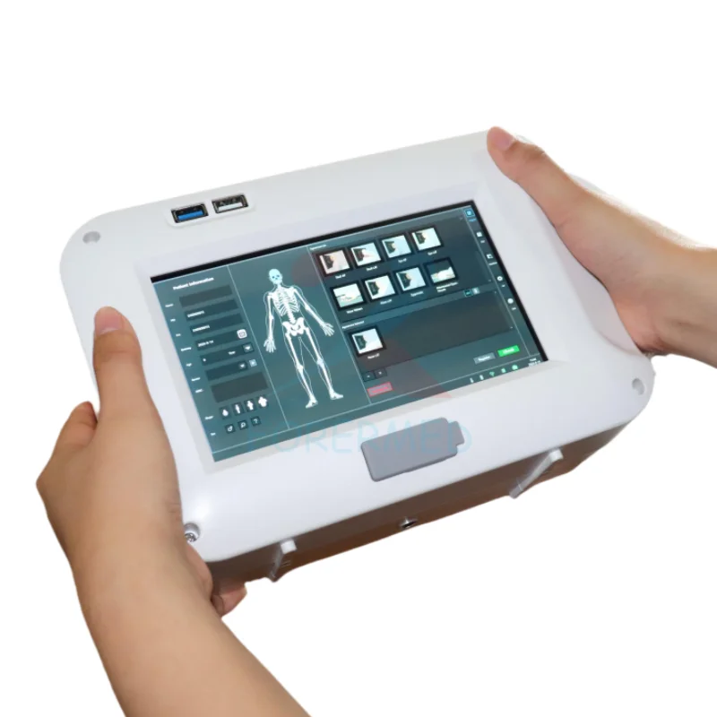 Human Veterinary System Wireless Portable Digital Xray Machine Touch Screen Free Triangular support DR Handheld X ray Equipment