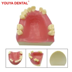 Model dentystyczny Implant Model zębów praktyki dentystycznej studenci stomatologii szkolą się w zakresie egzaminowania nauczania modeli wyświetlania edukacji