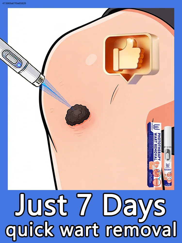 

Избавьтесь от бородавок и живите без прерываний в своем пути.