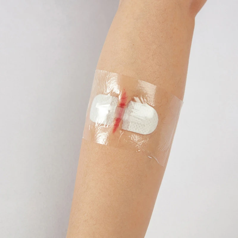 【B】Free Adhesive Tape For Wound Closure Strips Surgical Sutures Postpartum Wound Repair Cosmetic Adhesive