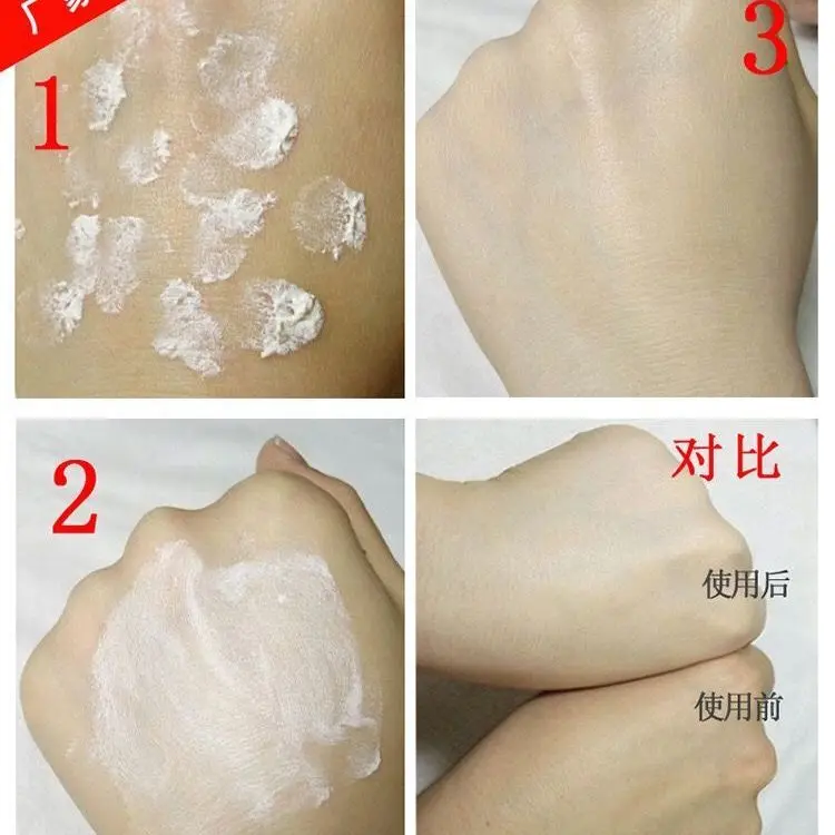 1kg Dark Skin Brightening Cream is a powerful, high-quality product for face, neck, hands and feet with no side effects