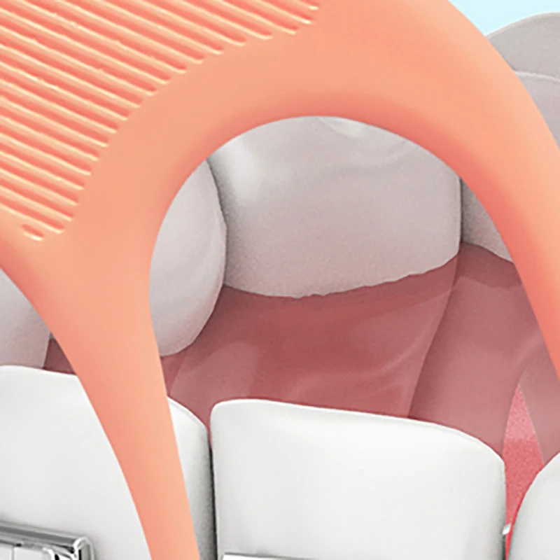 60Pcs Orthodontic Flossers For Braces - Ortho Dental Floss Picks For Adults & Kids Fits Under Arch Wire