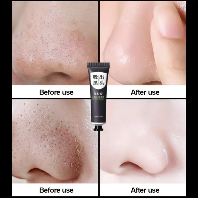 20g Blackhead Remover Face Mask Cream Oil-Control Nose Black Dots Mask Acne Deep Cleansing Beauty Cosmetics Women Skin Care