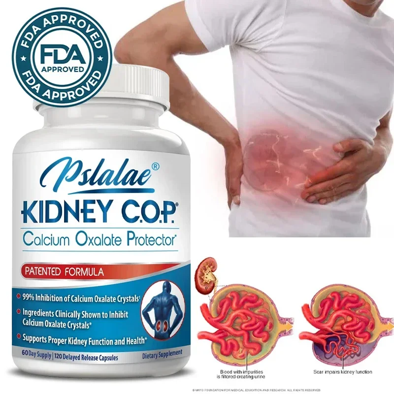 

Kidney COP Calcium Oxalate Protectant - Dietary Supplement, 30/60/120 Vegetarian Capsules