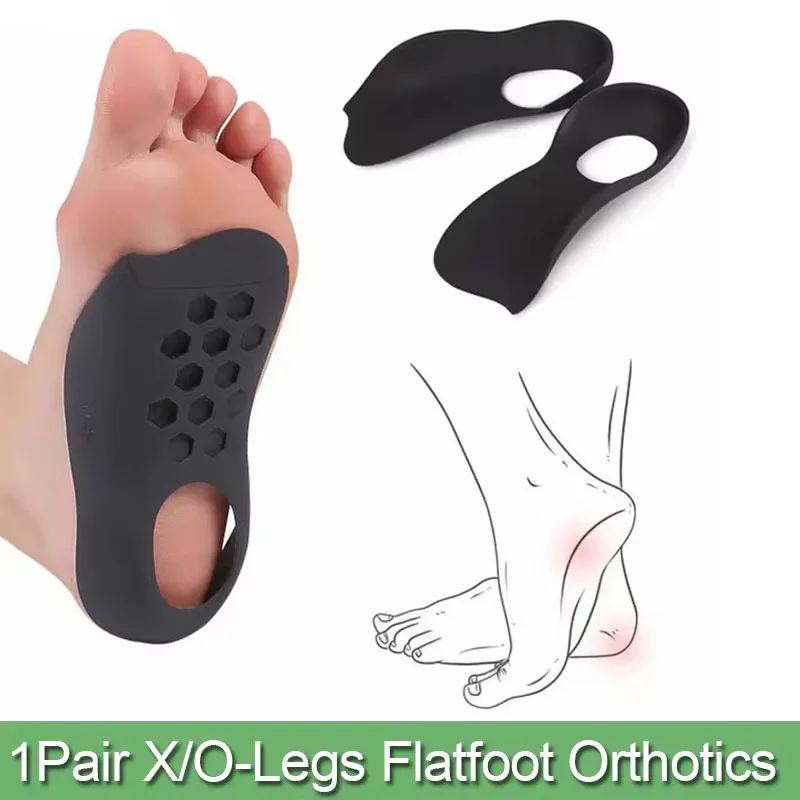 1Pair Orthotic for Flat Foot O-Shaped Legs Correction Arch Support Plantar Fasciitis Orthopedic Insoles