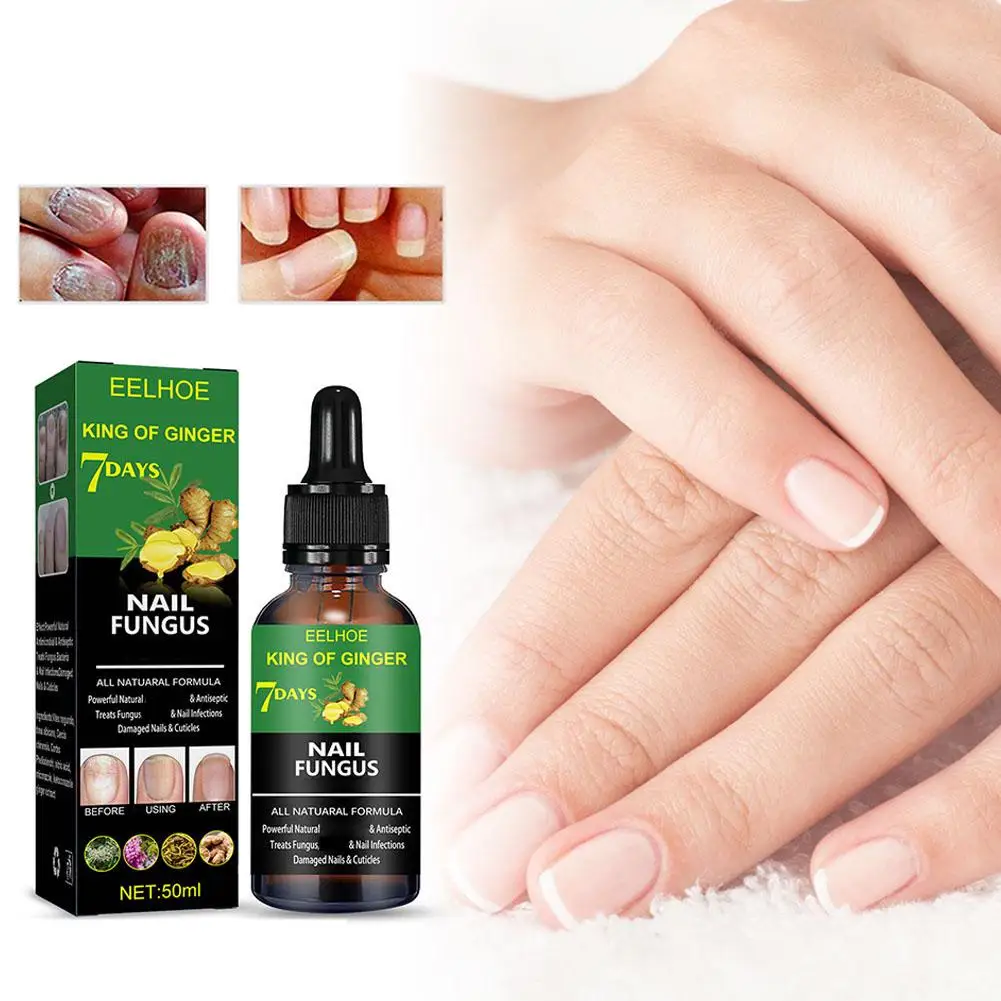 Nail Fungus Repair Liquid Anti-infective Paronychia Care Onychomycosis Fungal Removal Products Nails Health Nails 50ml V1F3