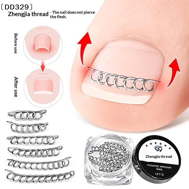 12Pcs/Box Ingrown Toe Nail Corrector Spring Wire Fixer Pedicure Recover Straightening Clip Patch Toenails Orthotic Foot 〔DD329〕