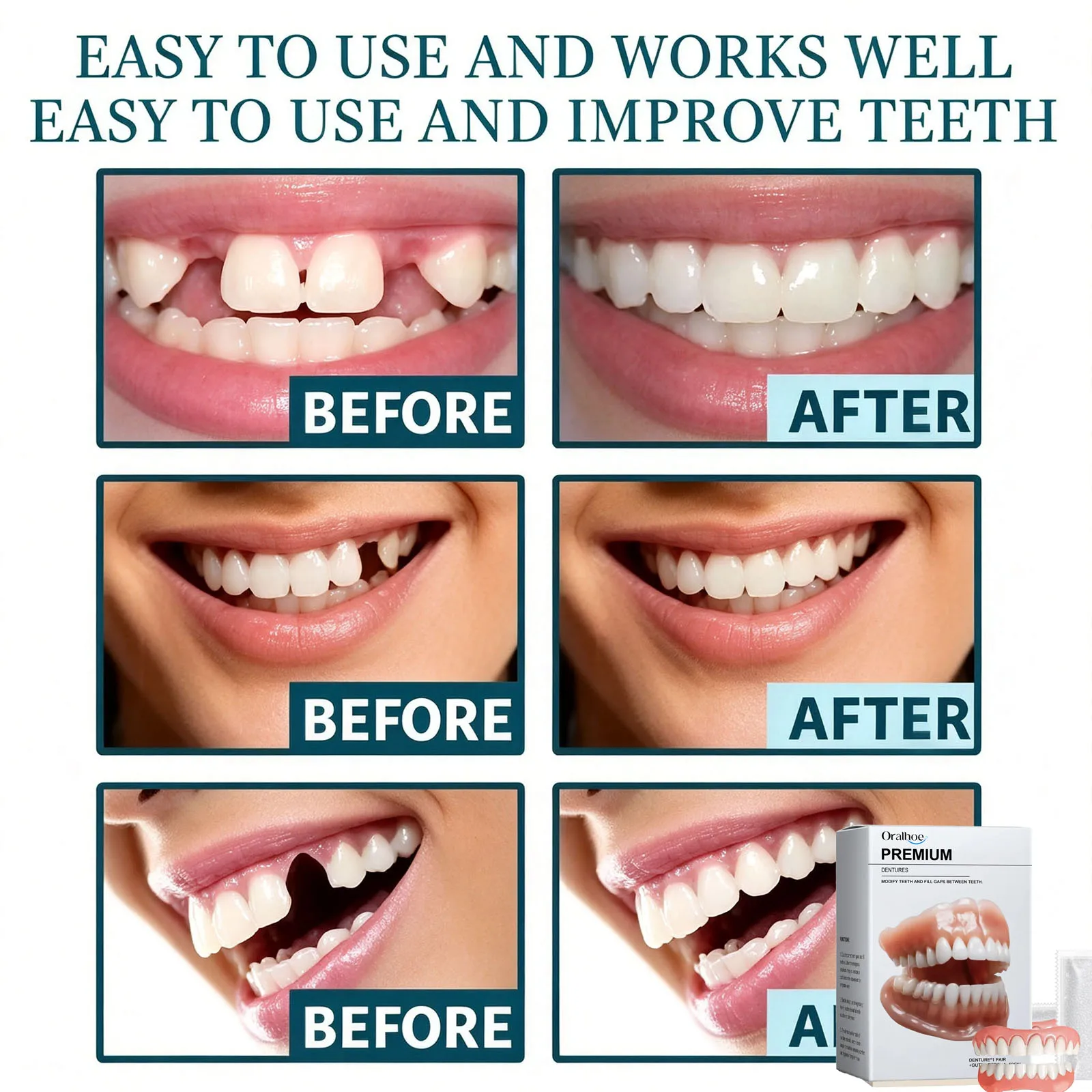 Soft Silicone Dentures to Eat Enhance Chewing Ability Improve Dark Tooth Loss Temporary Orthodontic Braces False Teeth Full Set