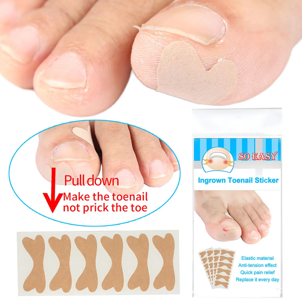 

24 Pcs Toenail Tape Corrector Healing Ingrown Patch Sticker Decals Applique