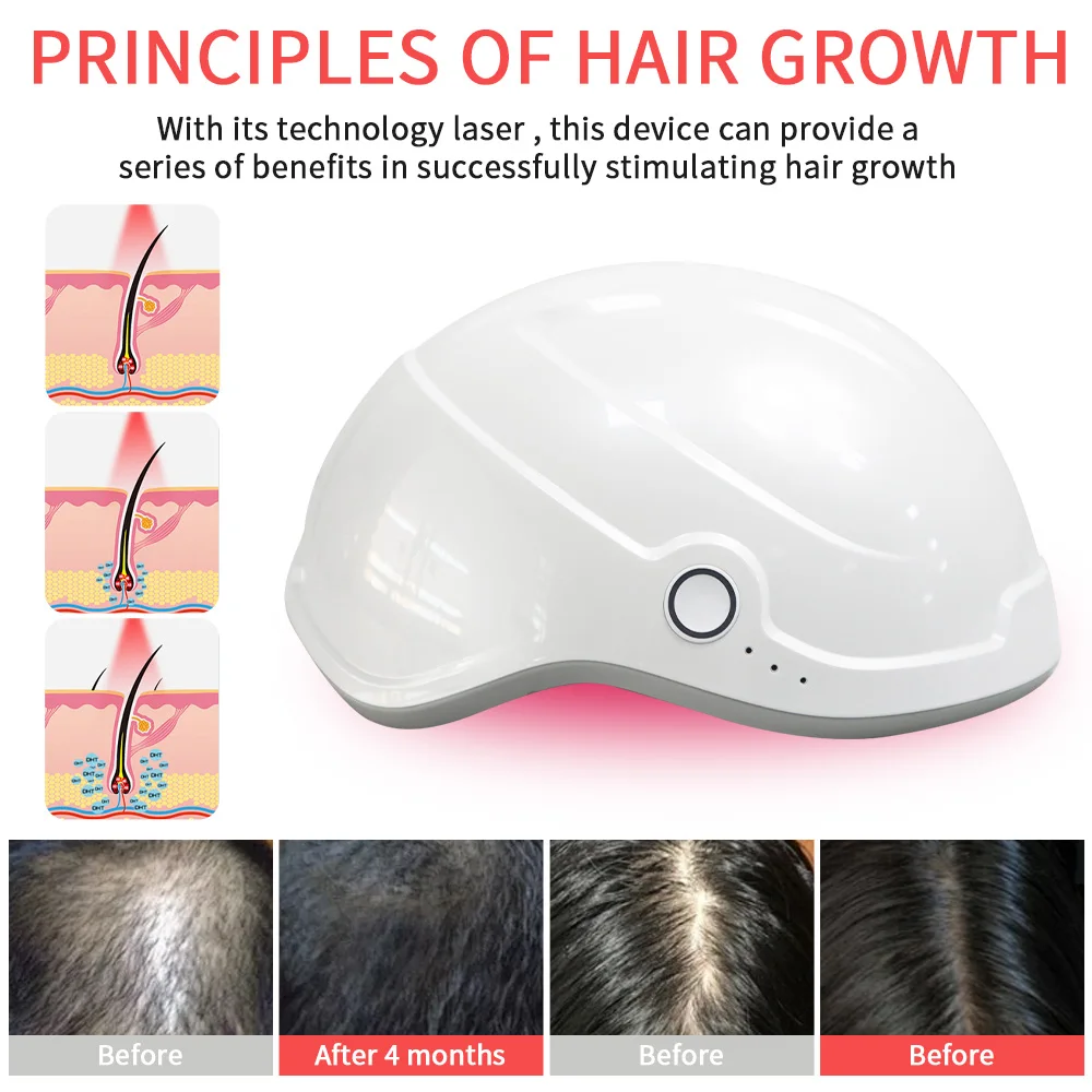 Professional Laser Helmet Head Massage Cap 82 Laser For Hair Regeneration Treatment Promoting Hair Growth Preventing Hair Loss