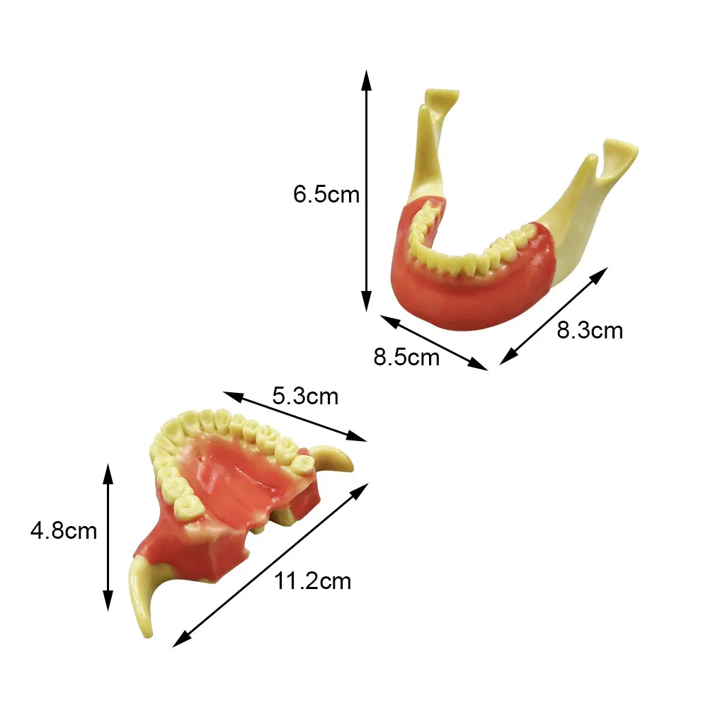 Dental Teeth Implant Practice Model Anchorage Nail Upper Lower Implant Training Model For Teaching Studying Education Display