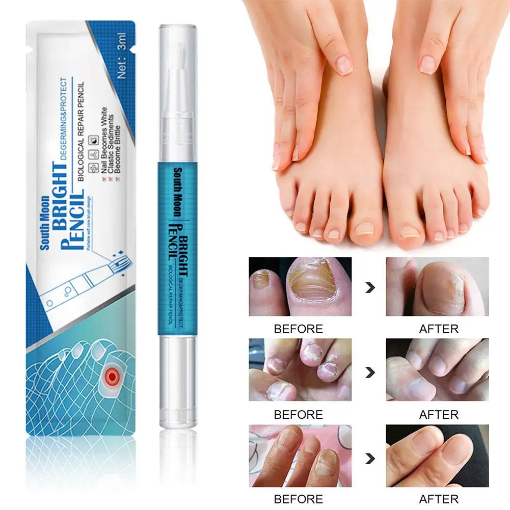 Solução de tratamento de unhas reutilizável para mulheres, essência eficaz do fungo do prego, nutrição leve, líquido reparador, Z6S3, 3ml