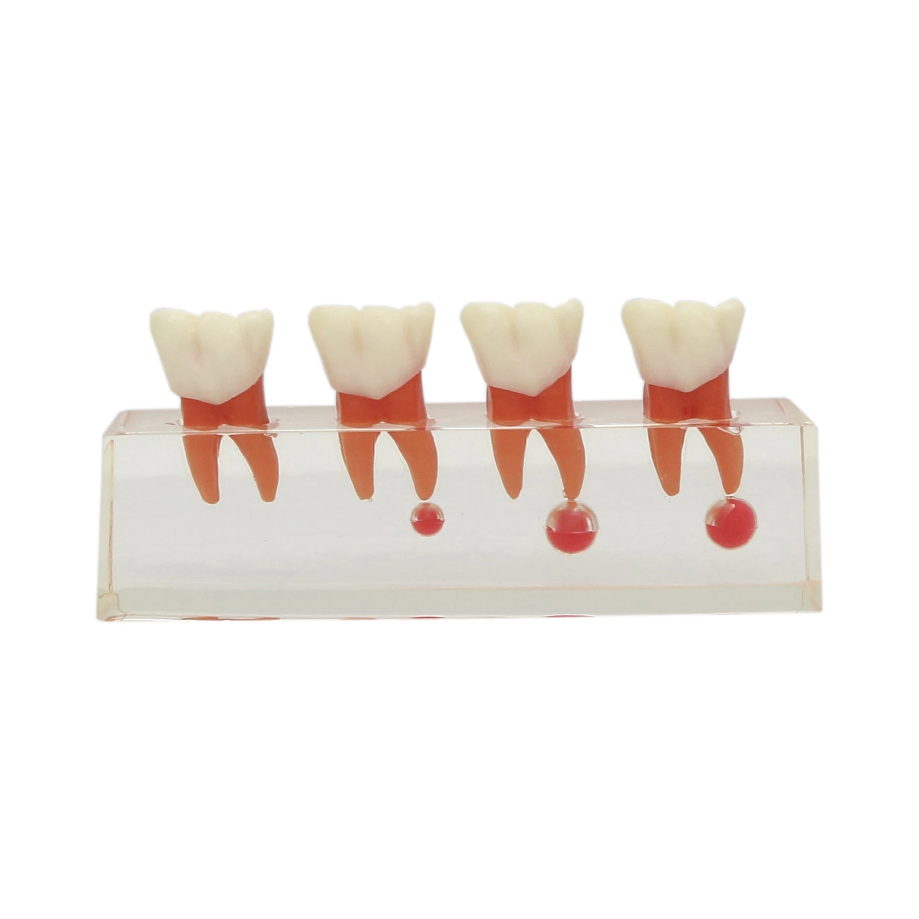 Dental Models Demo 4-Stages Endodontic Treatment For Teaching Studying Dentistry Laboratory Teeth Model