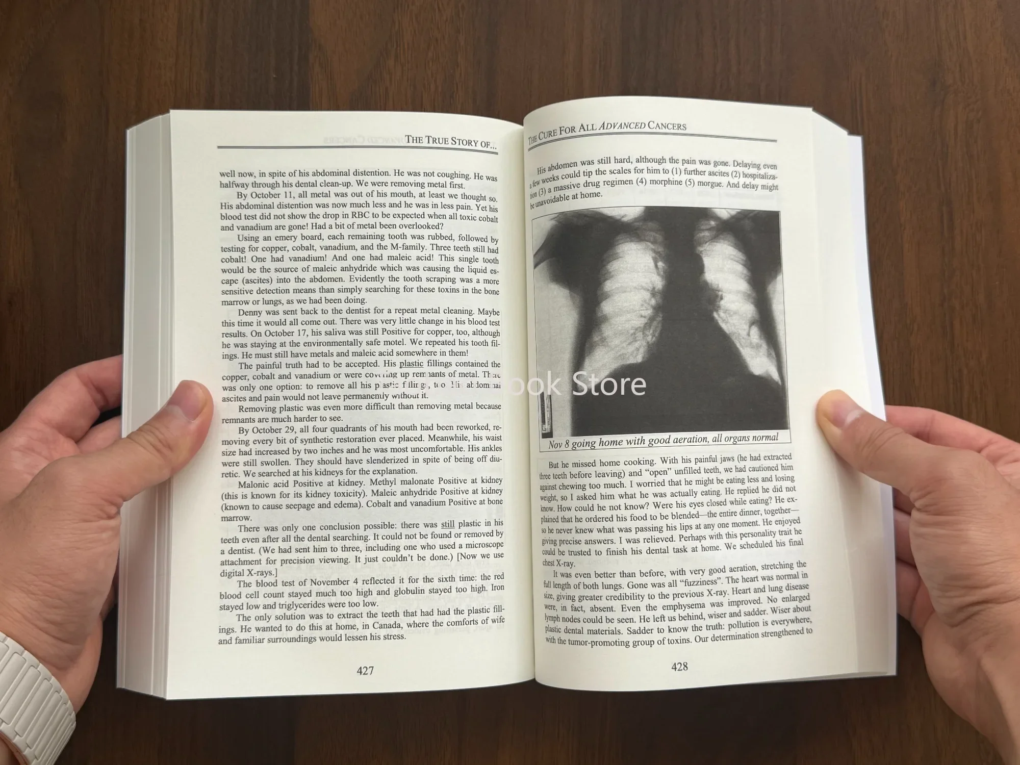 The Cure for All Advanced Cancers Book By Dr. Hulda Clark | Tumor Treatment Natural Therapy Guide  Libros