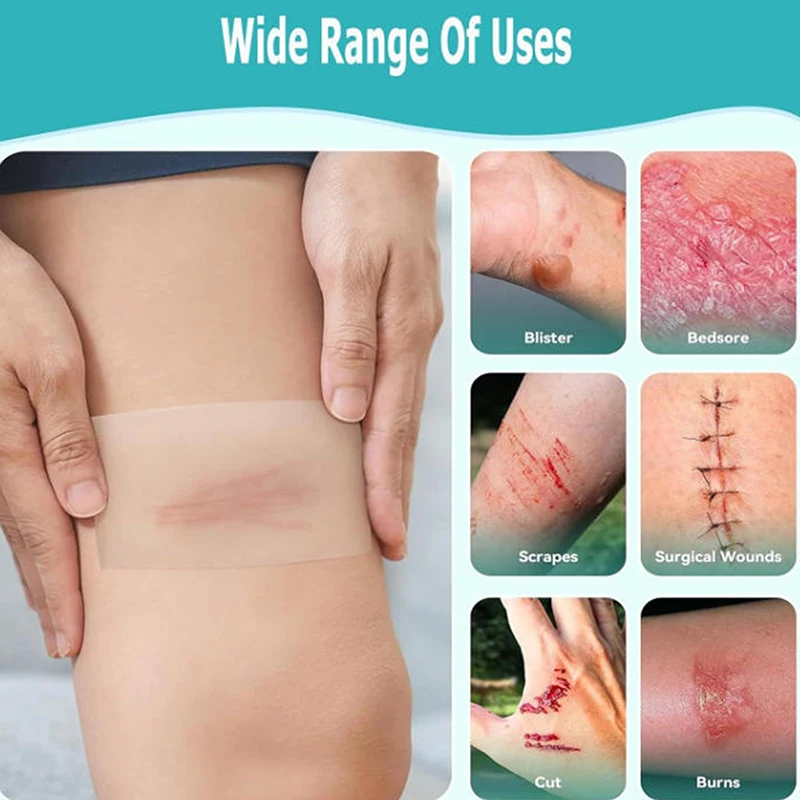 1 rollo de rollo hidrocoloide para el cuidado de heridas, vendajes hidrocoloides con autoadhesivo, vendajes para dolor de cama, altamente absorbentes