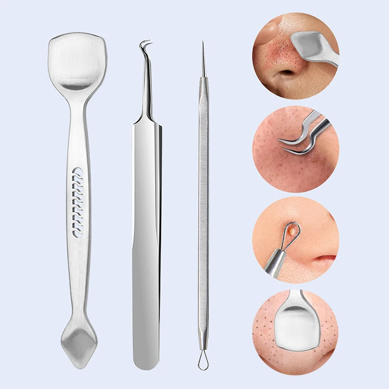 Rvs Mee-eter schop Dubbele Hoofd Remover Tool Puistje Acne Talg Verwijderen Gezicht Smet Extractor Gereedschap Gezicht Huidverzorging