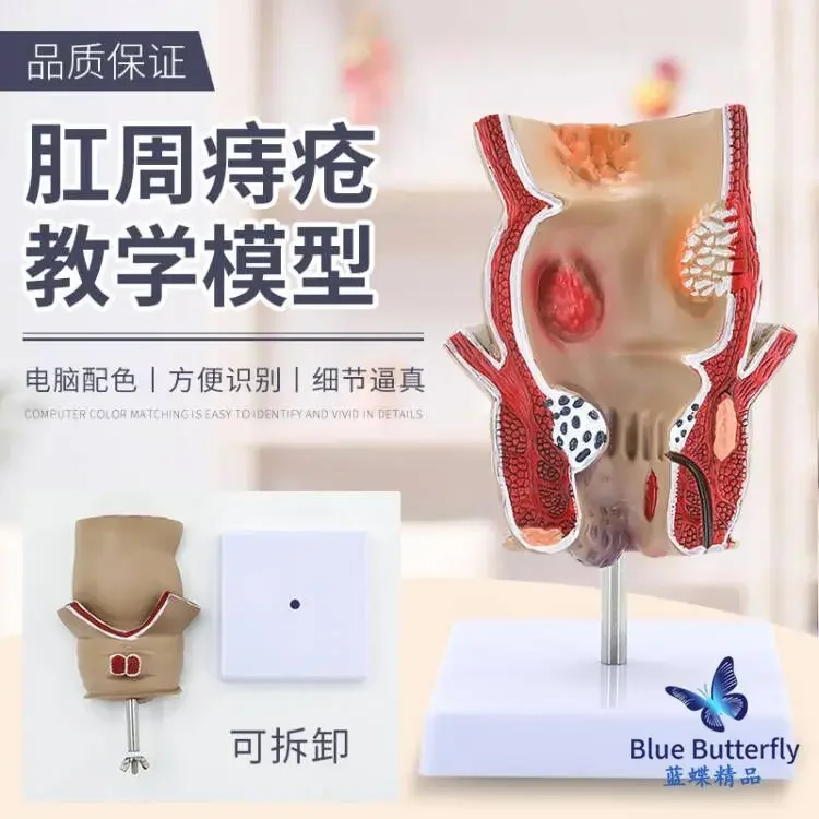 Rectal Hemorrhoids, Colorectal Lesions, Internal And External  Hemorrhoids, Anal And  Diseases, Pathology