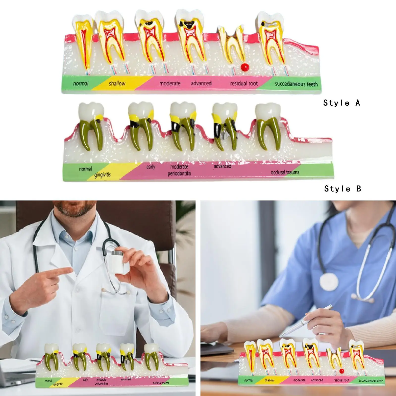 

Демонстрационная модель зуба, мягкое образование, чистый дисплей, съемная стоматологическая модель, обучающий инструмент для обучения зубами, стандартный зуб
