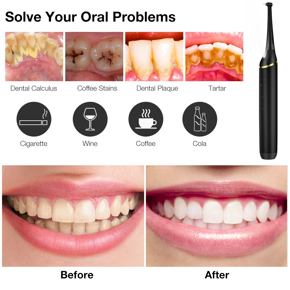 Electric Ultrasonic Dental Scaler 5 Modes Calculus Oral Tartar Remover Tooth Stain 9 Levels Cleaner Teeth Whitening Oral Care image 5